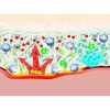 SUPRASORB X +PHMB 5 cm x 5 cm