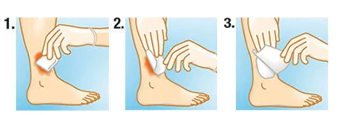 SUPRASORB A+Ag  antimikrobiális kálcium-alginát kötszer ezüsttel 10 x 10 cm
