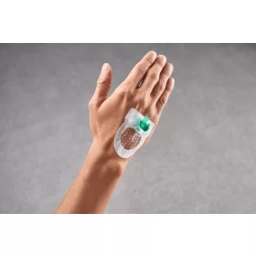   Curafix i.v. Control (5,5 x 6,5 cm) steril kontrollablakos kanülrögzítő tapasz