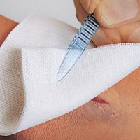 KÖTSZEREK, SEBELLÁTÁS