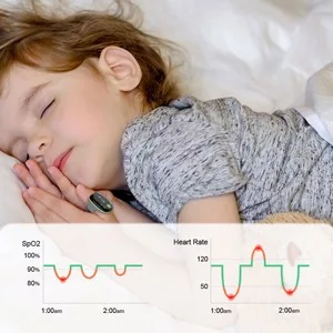 Viatom gyerek oxigén monitor