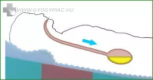 Gyopár (anti)reflux párna 50x70x20 cm (kicsi)