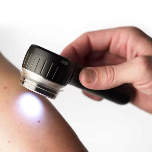 Dermatoszkóp DermLite DL4 /