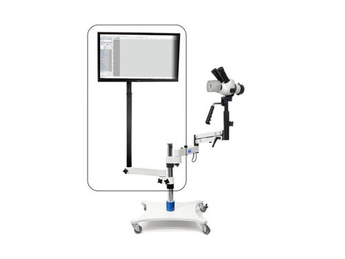 Monitor tartó Alpha G20 kolposzkóphoz