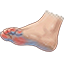 Neuropátia